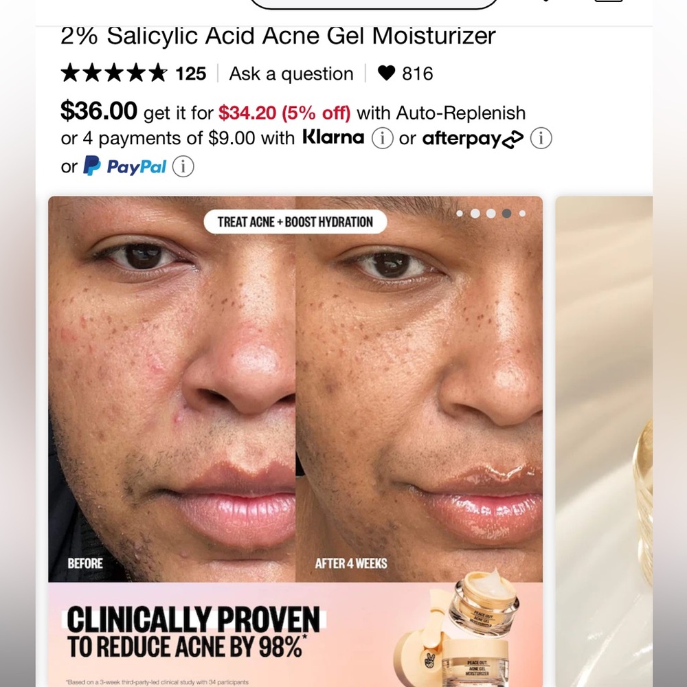 Peace Out Acne Gel Moisturizer - Picture 3 of 8